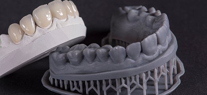 Green 3D-printing for Dental Appliances